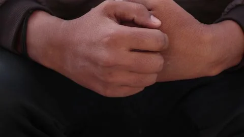 Man suffering from itching hand, may be caused by allergies Stock Footage 145198316