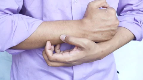 Man suffering from itching skin, close up. Stock Footage 153526513