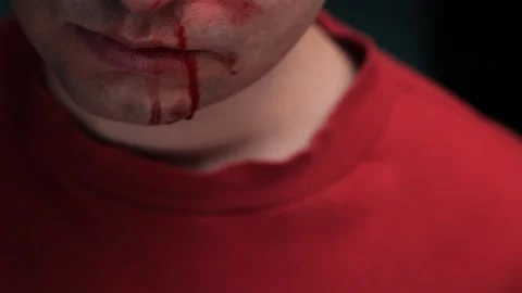 Man suffering from nose bleeding wearing red sweatshirt Stock Footage 306801276