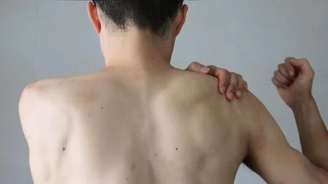 A man suffering from stiff shoulders, seen from behind. Stock Photos