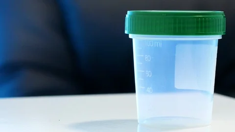 A man takes an empty container for sperm on the table. Analysis of semen Video stock 117810888