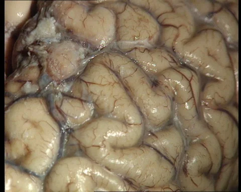 Man is talking about how our brain and body works, United Kingdom, 1995 Stock Footage 142215451