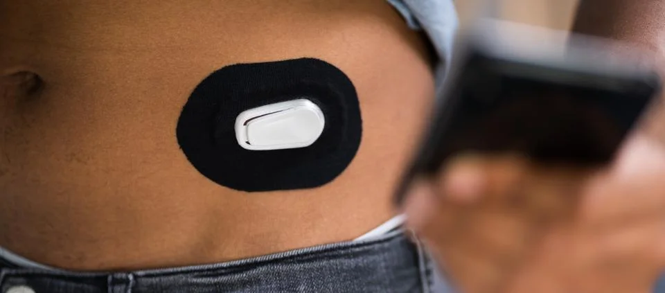 Man Testing Glucose Level With Continuous Glucose Monitor Stock Photos