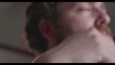 Man thinking with psoriasis on his arm Stock Footage 135898618