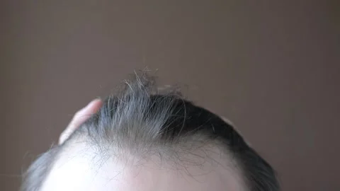 Man touching her hair close-up on brown background, hair loss concept. Stock Footage 247526142