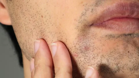 A man touching his beard Stock Footage 336561903
