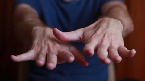 Man with tremored hands 스톡 동영상 65370823