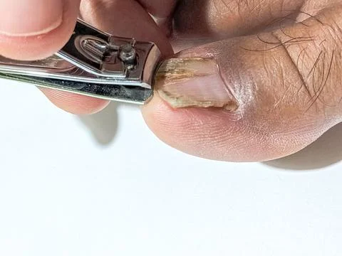 Man trimming toenail using clipper for foot care and hygiene maintenance at home Stock Photos