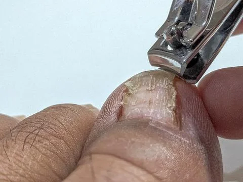 Man trimming toenail using clipper for foot care and hygiene maintenance at home Stock Photos
