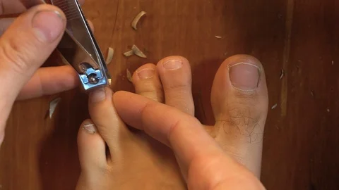 A man trims nails on his left leg. Big nails Stock Footage 120751471