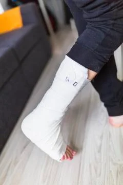 The man is trying to walk with a broken leg Stock Photos