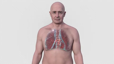 Man with tuberculosis, animation Stock Footage 295183636