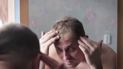 Man upset by hair loss or dandruff Stock Footage