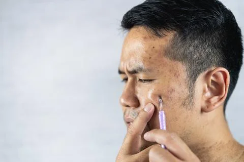 Man using acne remover on his face on gray background Stock Photos
