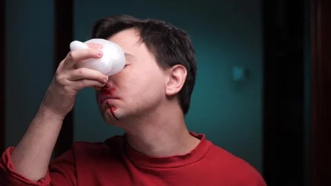 Man using ice pack on nose to stop bleeding after injury Stock Footage 306802061
