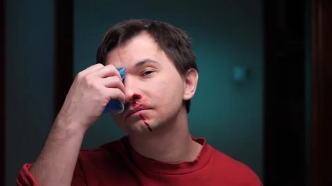 Man using ice pack for nosebleed and bruising injury Stock Footage 306802293