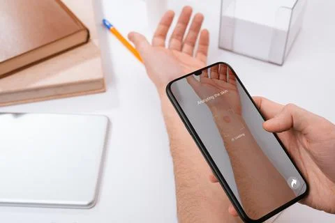 Man using a phone app to identify a red spot on his hand Stock Photos