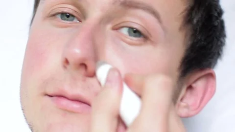 A man using a remedy for acne and acne on his face Stock Footage 76977284