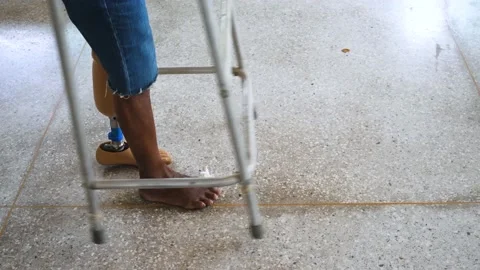 Man with walkingwith leg prosthesis Video stock 148642516