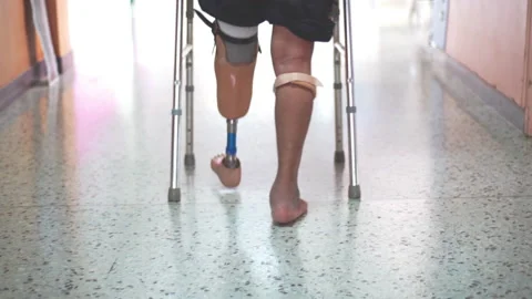 Man with walkingwith leg prosthesis Video stock 148646493