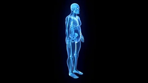 Man Weight Loss, X-Ray Stock-Footage 73840439