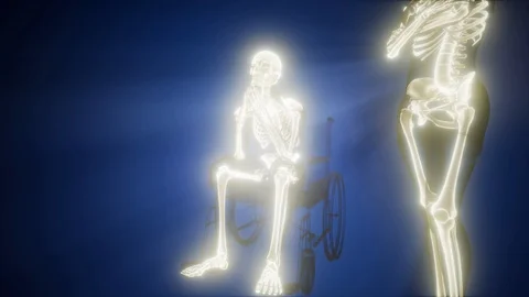 Man in wheelchair with visible bones Video stock 88795718