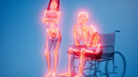 Man in wheelchair with visible bones Stock Footage 164640209
