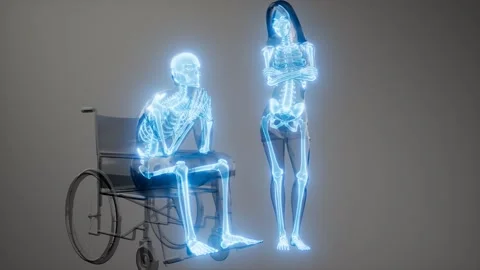 Man in wheelchair with visible bones Stock Footage 166346545