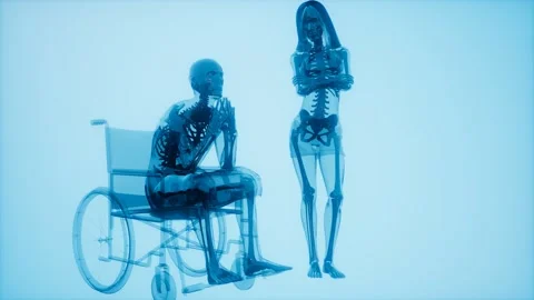 Man in wheelchair with visible bones Stock Footage 201332369