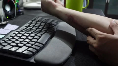A man who feels irritated at work because of itchy skin which causes red ir.. Stock Footage 320851204