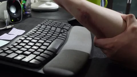 A man who feels irritated at work because of itchy skin which causes red ir.. Stock Footage 320851215