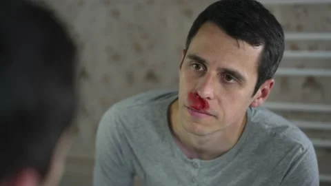 Man wipes nosebleed in a front of the mirror Stock Footage 156841471