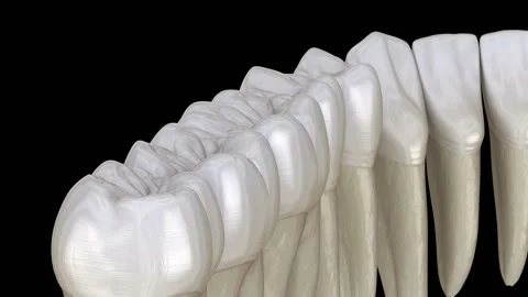 Mandibular teeth, macro view. Medically ... | Stock Video | Pond5
