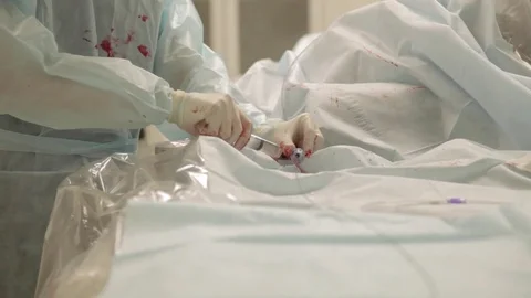 Manipulation in the operating room Stock Footage 81355800