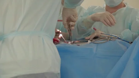 Manipulations during an operation Stock Footage 81355647