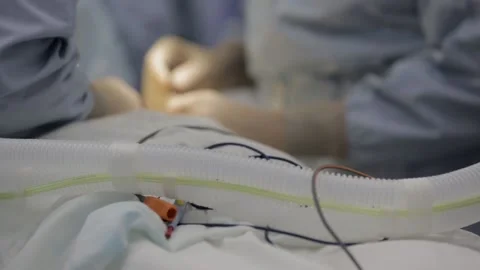 Manipulations in operating room Stock Footage 154586271