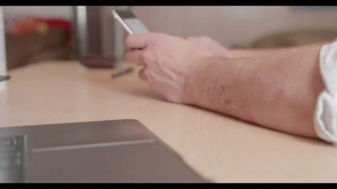 Man's arm with psoriasis texting Stock Footage 135899801