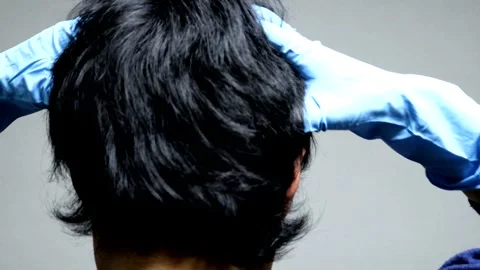 A man's back as he massages his scalp. Video stock 336165527