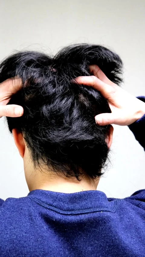 A man's back as he massages his scalp. Stock Footage 336168739