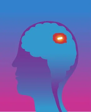 Man's brain with mental pill inside, cross section, illustration Stock Illustration