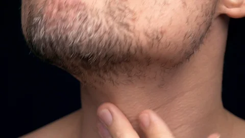 Man's face before and after shaving Stock Footage 102126594
