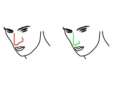The man's face and the reshaping of the nose. Rhinoplasty. Stock Illustration