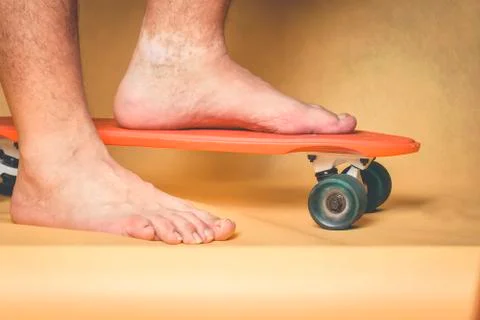 Man's feet with skin pigmentation problems on the ankle Stock Photos