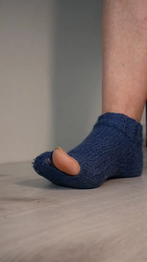 A man's foot in an old blue sock with a hole in the big toe. holey sock Stock Footage 304279871