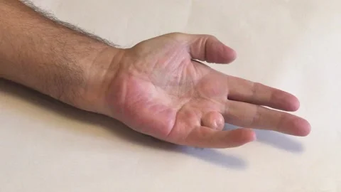 Mans left hand having had third finger amputated Stock Footage