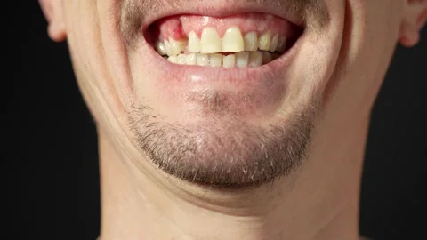 Man's smile without teeth, close-up. Stock Footage 253376439