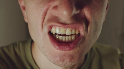 The man's teeth are chattering Stock Footage 317957890