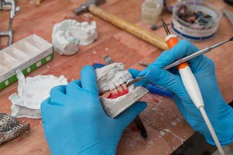 Manufacturing of dentures Stock Photos