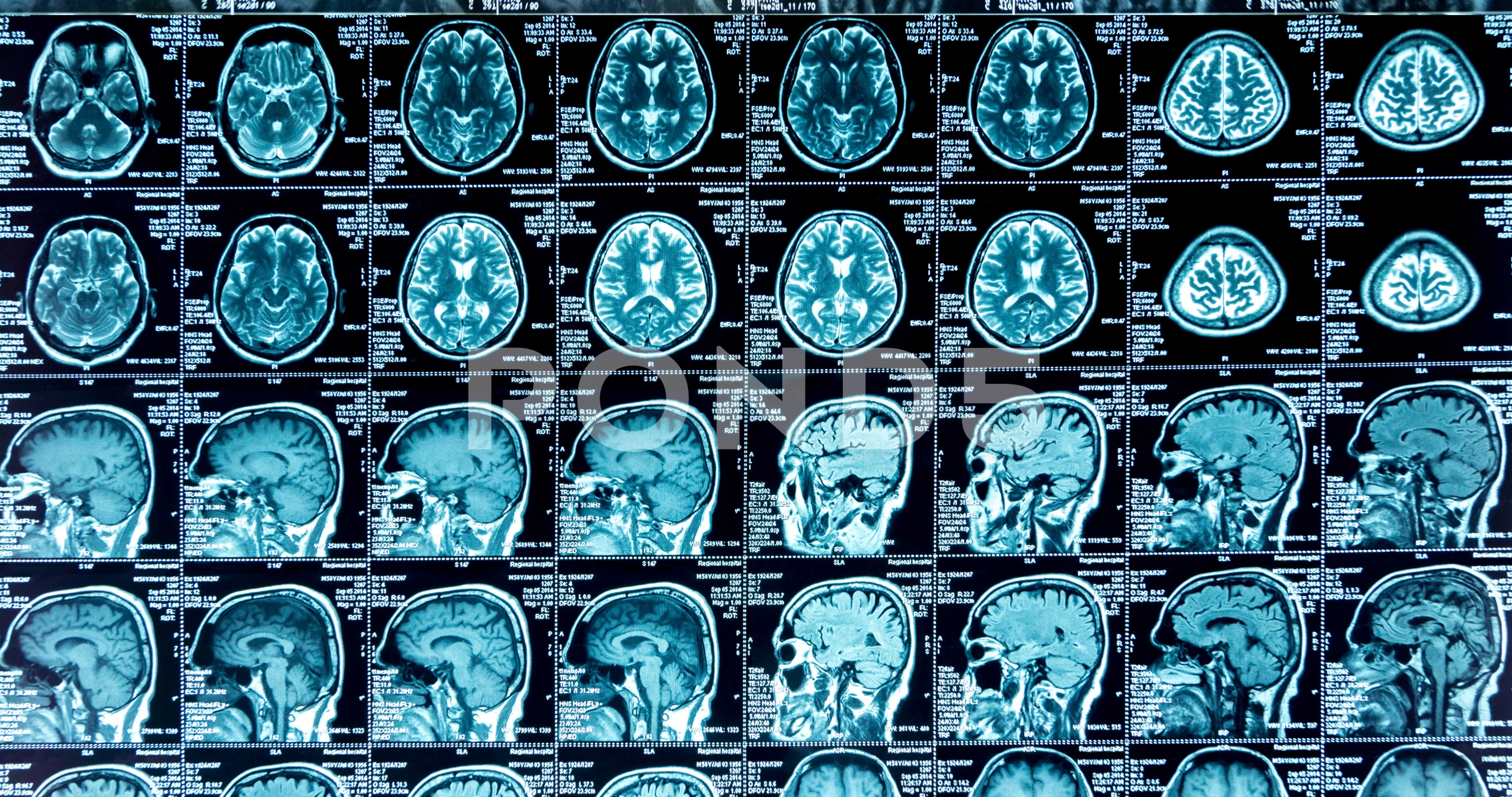 Mri Scans Stock Footage Royalty Free Stock Videos Pond5 Mri Scans Stock Footage Royalty Free Stock Videos Pond5