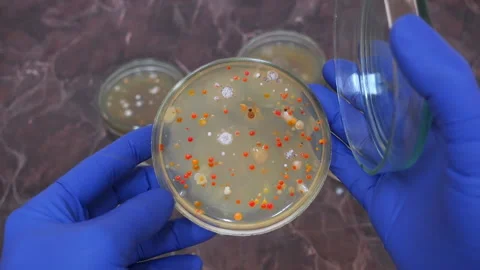 Many round colonies of bacteria of different colors. Stock Footage 177475635